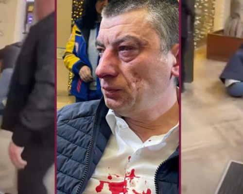 “შერატონში” ადასტურებენ, რომ გახარიაზე თავდასხმის სრული ჩანაწერი არსებობს