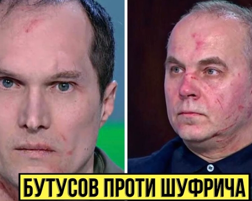 უკრაინაში ჟურნალისტმა შუსტერის თოქ-შოუში უმაღლესი რადას პრორუსულად განწყობილი დეპუტატი ცემა